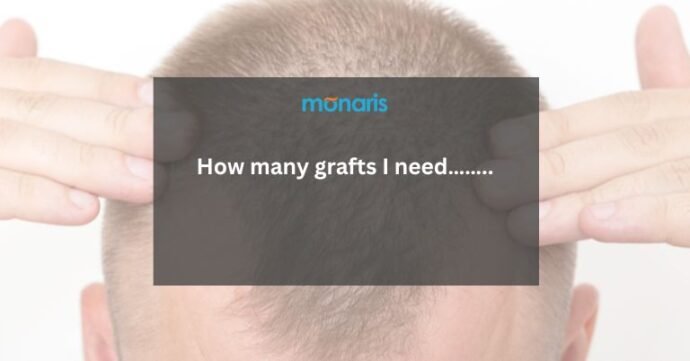 How many grafts I need……..