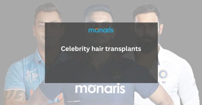 Celebrity hair transplants