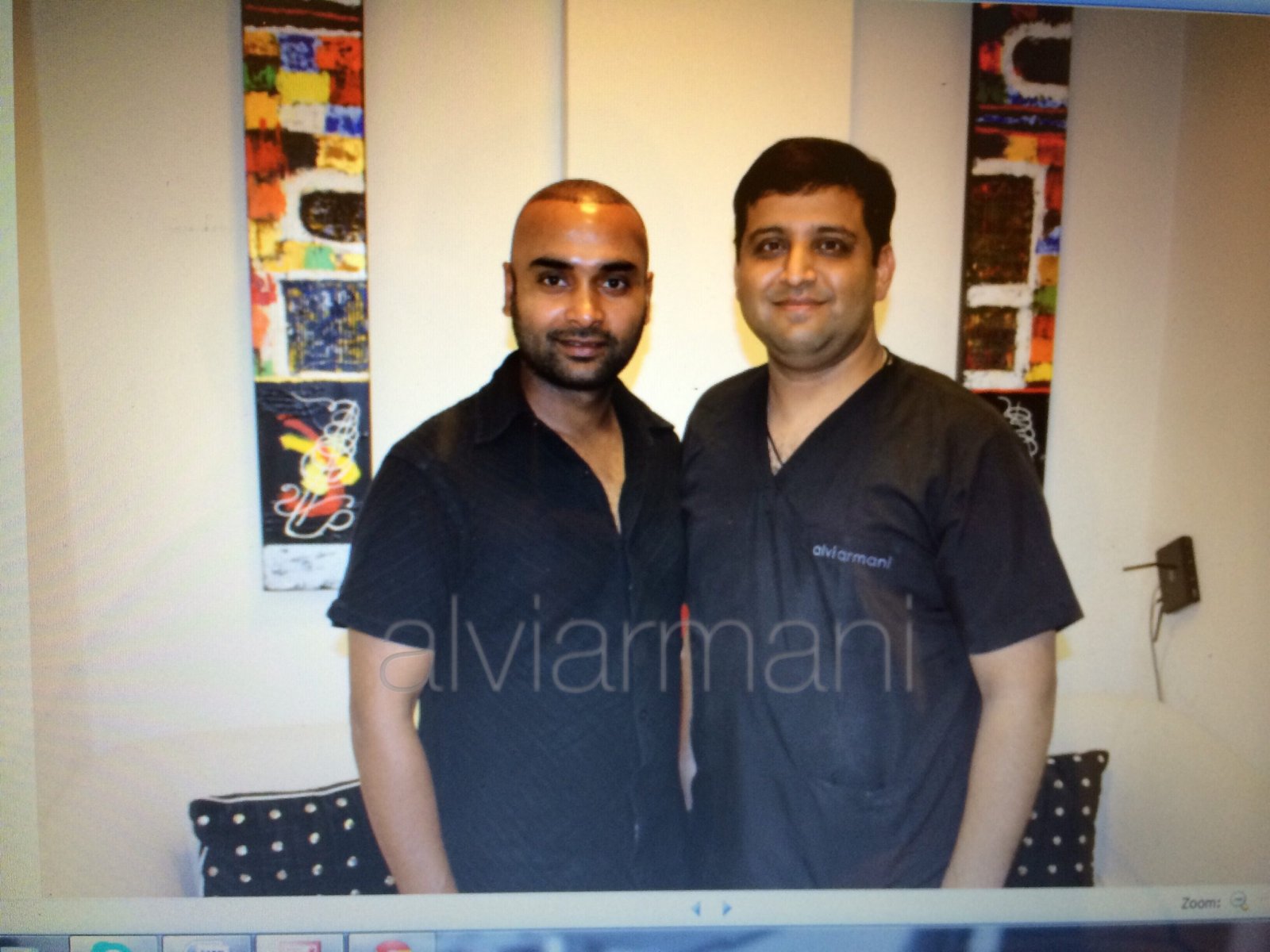 Amit Mishra hair transplant Dr. Arihant Surana