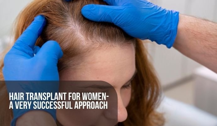 Hair Transplant for Women-A very successful approach