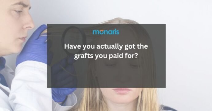 Have you actually got the grafts you paid for?