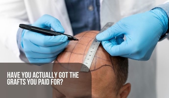 Have you actually got the grafts you paid for?