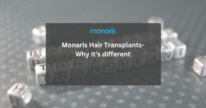 Monaris Hair Transplants-Why it's different