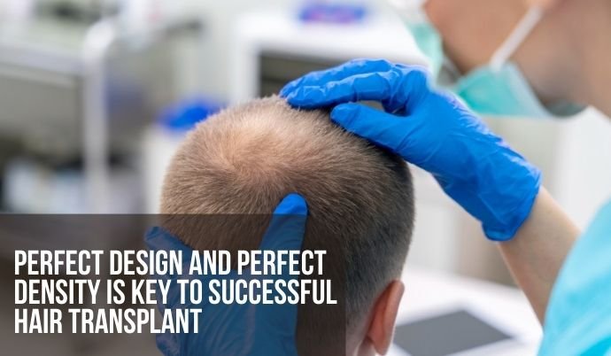 Perfect Design and Perfect density is key to Successful Hair transplant