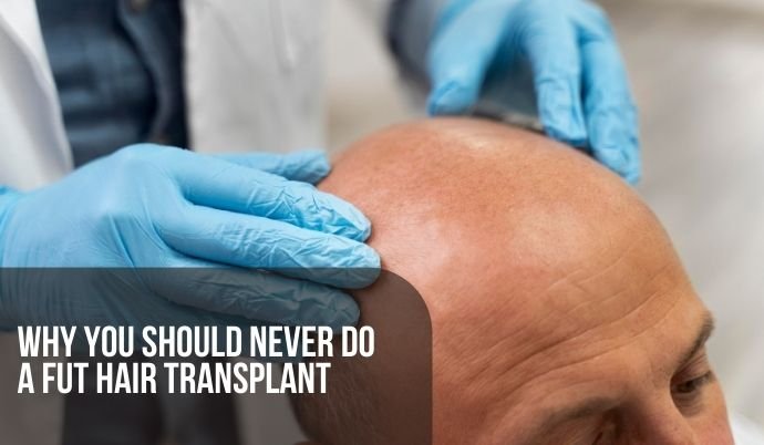 Why you Should NEVER Do A FUT Hair Transplant