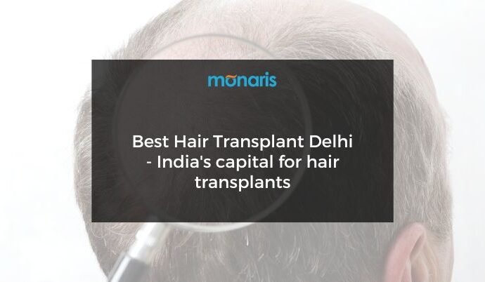 Best Hair Transplant Delhi - India's capital for hair transplants