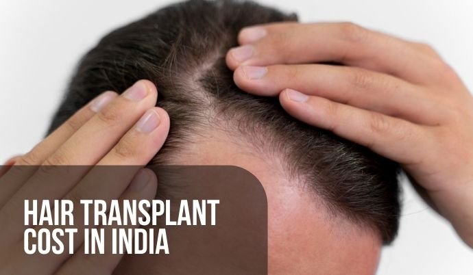 Hair Transplant cost in India